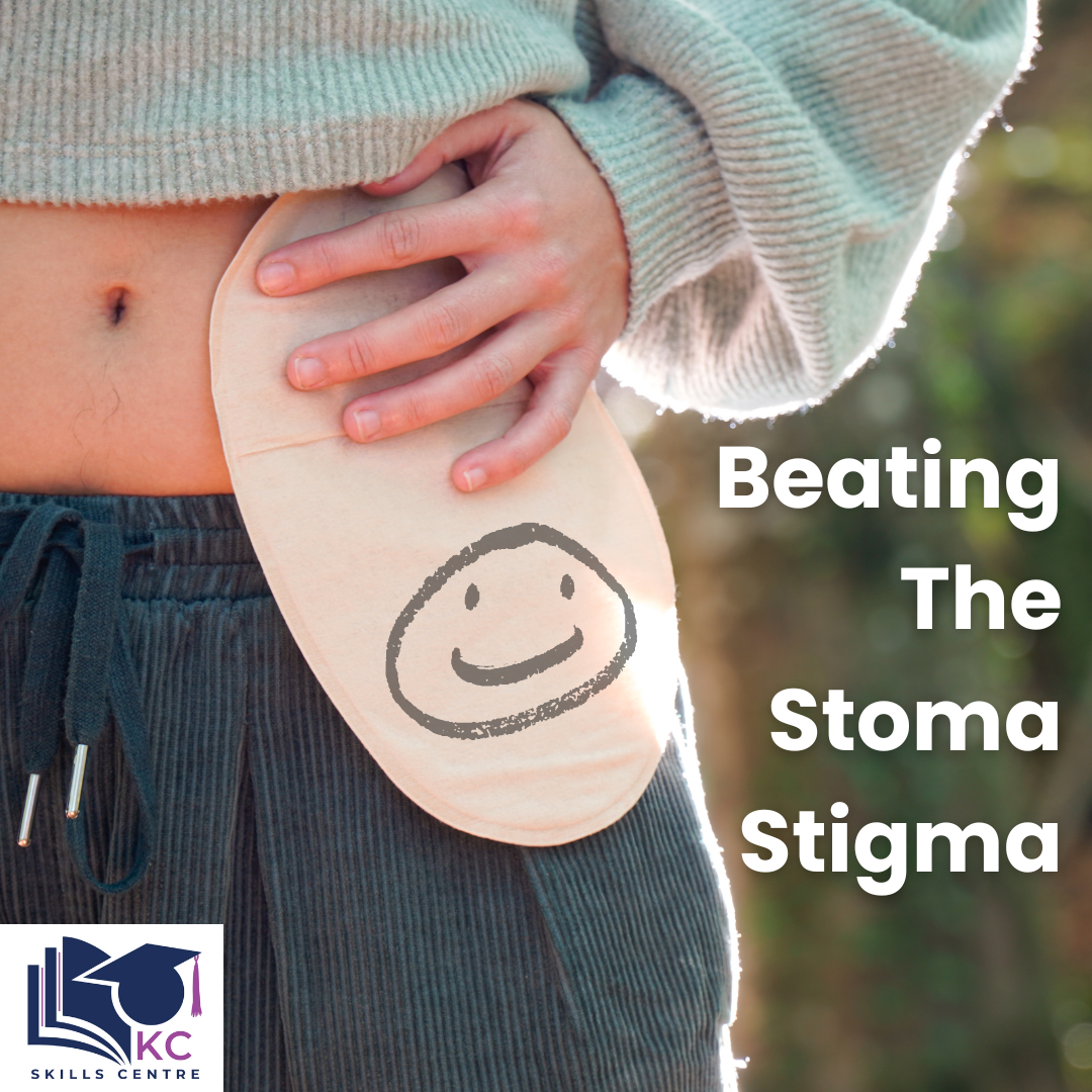 living with a stoma