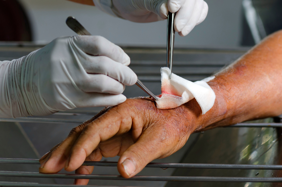 complex wound assistance care medical manage antiseptic dressing
